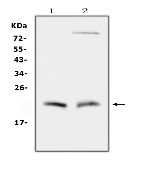 Cytoglobin Antibody in Western Blot (WB)