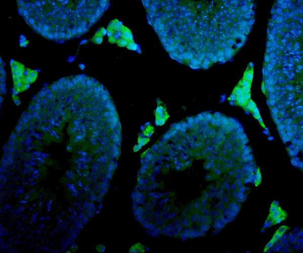 CYP17A1 Antibody in Immunohistochemistry (IHC)