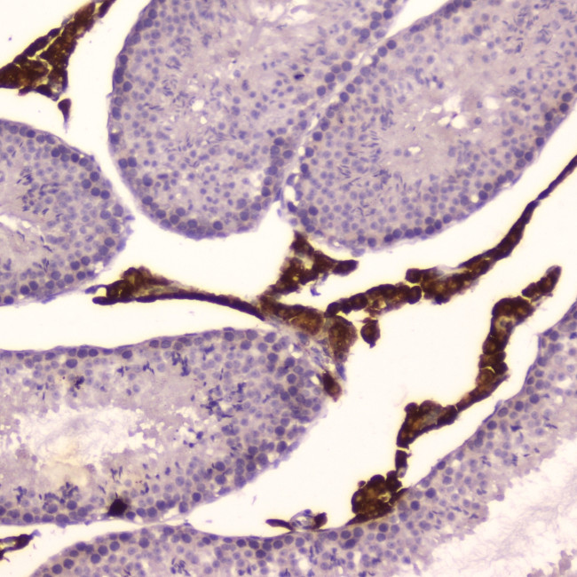 CYP17A1 Antibody in Immunohistochemistry (Paraffin) (IHC (P))