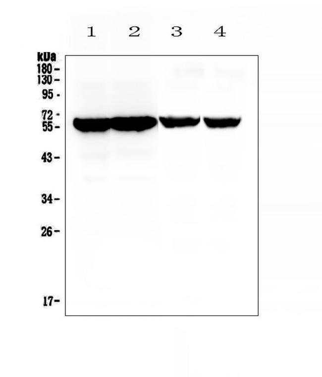 CYP17A1 Antibody in Western Blot (WB)