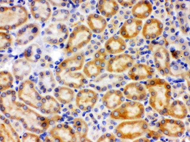 CYP27B1 Antibody in Immunohistochemistry (Paraffin) (IHC (P))