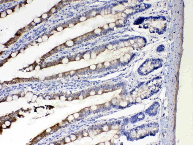 CYP2D6 Antibody in Immunohistochemistry (Paraffin) (IHC (P))