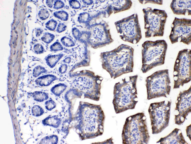 CYP2D6 Antibody in Immunohistochemistry (Paraffin) (IHC (P))