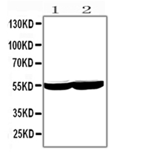 CYP2E1 Antibody in Western Blot (WB)