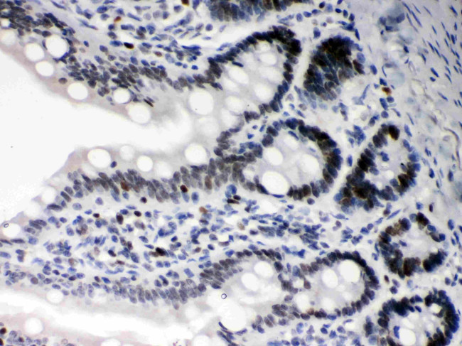 DAXX Antibody in Immunohistochemistry (Paraffin) (IHC (P))