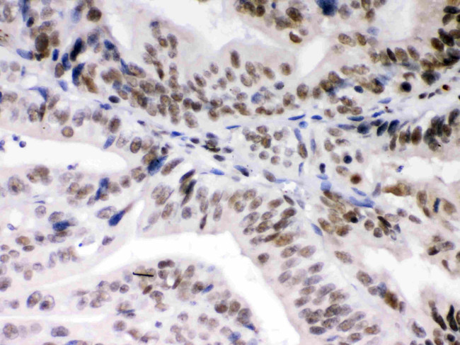 DAXX Antibody in Immunohistochemistry (Paraffin) (IHC (P))