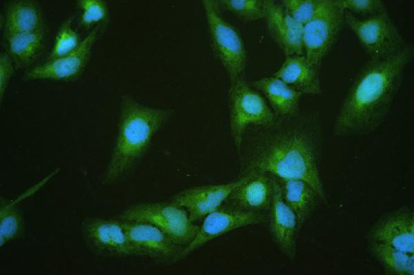 DBI Antibody in Immunocytochemistry (ICC/IF)