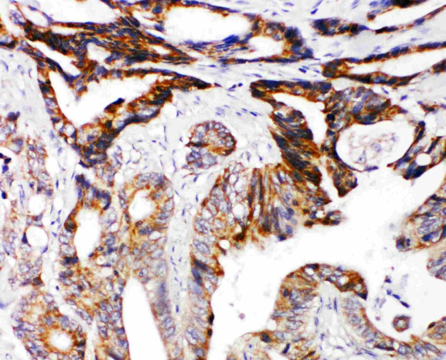 DCC Antibody in Immunohistochemistry (Paraffin) (IHC (P))