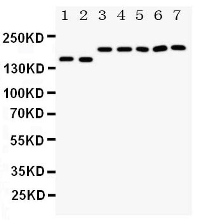 DCC Antibody in Western Blot (WB)