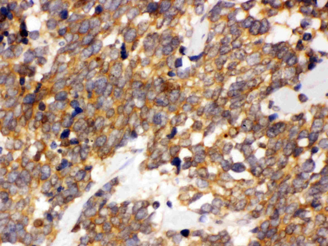 DDAH2 Antibody in Immunohistochemistry (Paraffin) (IHC (P))