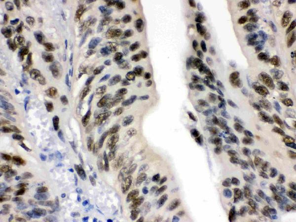 DDB1 Antibody in Immunohistochemistry (Paraffin) (IHC (P))