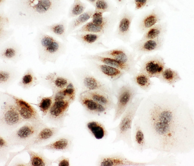 DDX4 Antibody in Immunocytochemistry (ICC/IF)