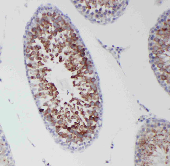 DDX4 Antibody in Immunohistochemistry (Paraffin) (IHC (P))