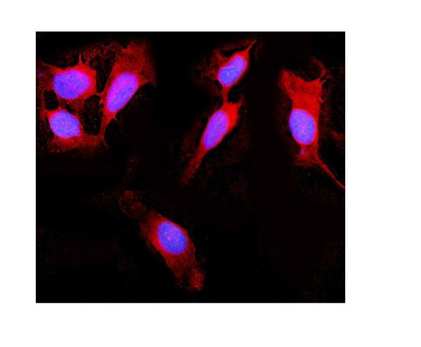 RIG-I Antibody in Immunocytochemistry (ICC/IF)