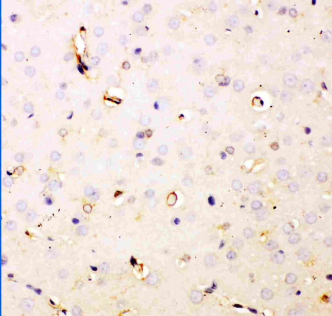 DHFR Antibody in Immunohistochemistry (Paraffin) (IHC (P))