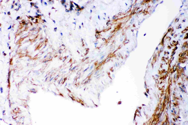 DHFR Antibody in Immunohistochemistry (Paraffin) (IHC (P))