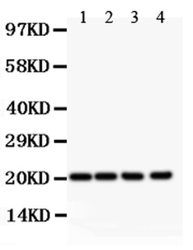 DHFR Antibody in Western Blot (WB)