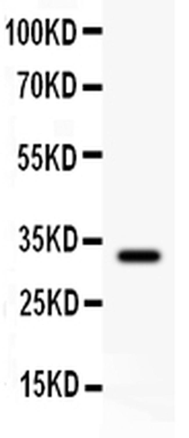 DHFR Antibody in Western Blot (WB)