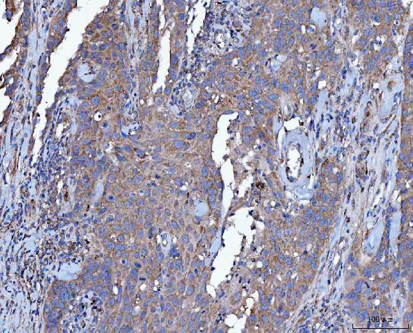 Dicer Antibody in Immunohistochemistry (Paraffin) (IHC (P))