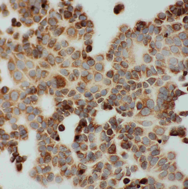 DLD Antibody in Immunocytochemistry (ICC/IF)