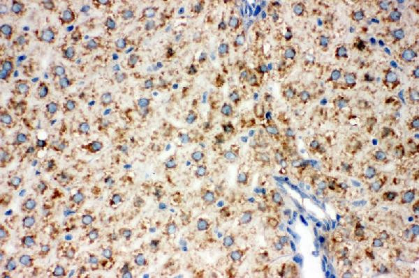 DLD Antibody in Immunohistochemistry (Paraffin) (IHC (P))