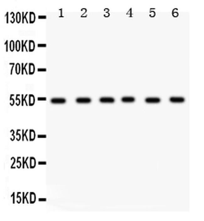 DLD Antibody in Western Blot (WB)