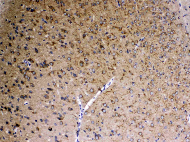 SAP102 Antibody in Immunohistochemistry (Paraffin) (IHC (P))