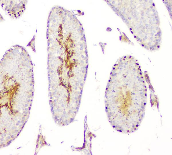 DMRT1 Antibody in Immunohistochemistry (Paraffin) (IHC (P))