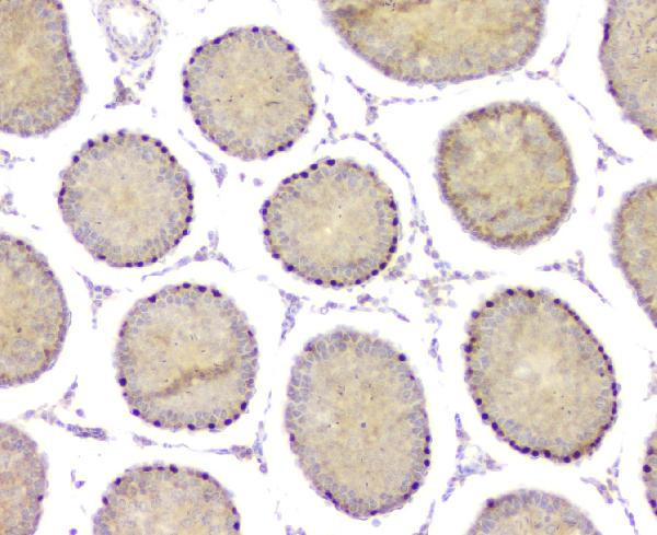 DMRT1 Antibody in Immunohistochemistry (Paraffin) (IHC (P))