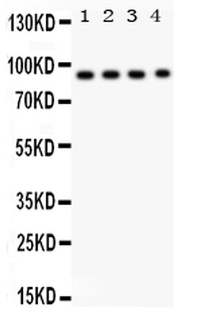 CD26 Antibody in Western Blot (WB)