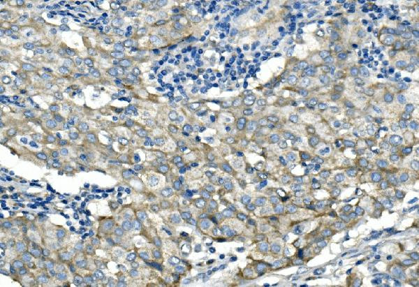 Desmoglein 2 (DSG2) Antibody in Immunohistochemistry (Paraffin) (IHC (P))