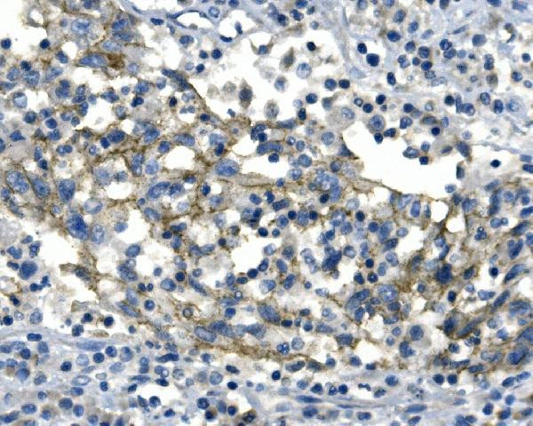 Desmoglein 2 (DSG2) Antibody in Immunohistochemistry (Paraffin) (IHC (P))