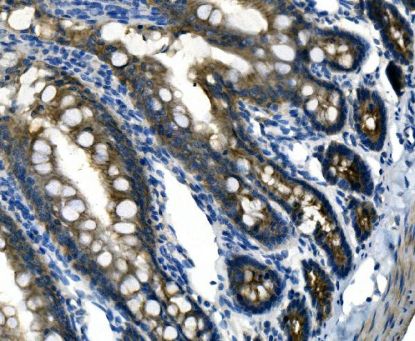 Desmoglein 2 (DSG2) Antibody in Immunohistochemistry (Paraffin) (IHC (P))