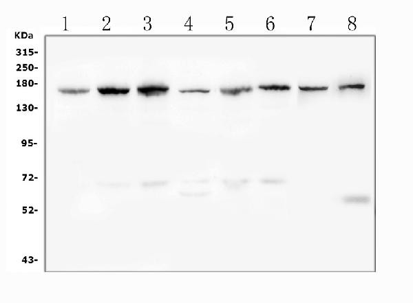 Desmoglein 2 (DSG2) Antibody in Western Blot (WB)