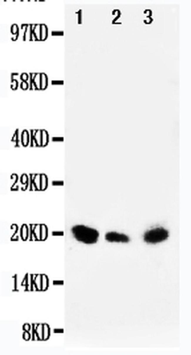 DUSP3 Antibody in Western Blot (WB)