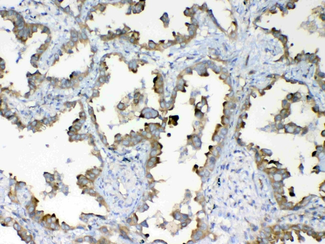 DYNLT1 Antibody in Immunohistochemistry (Paraffin) (IHC (P))