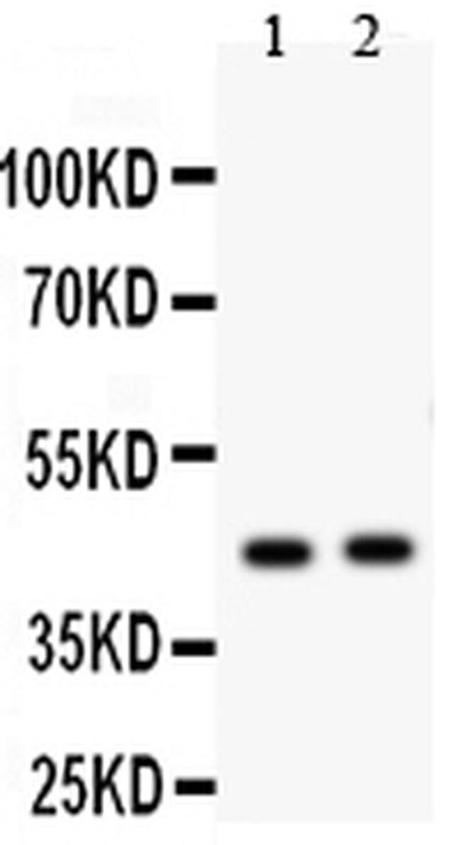 E2F4 Antibody in Western Blot (WB)