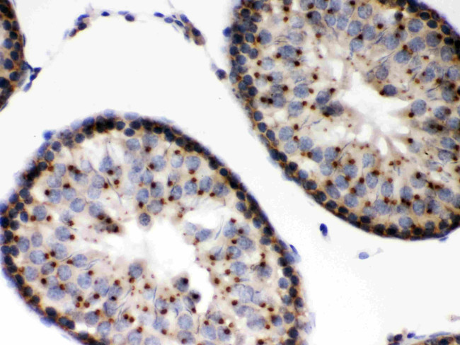 EBAG9 Antibody in Immunohistochemistry (Paraffin) (IHC (P))