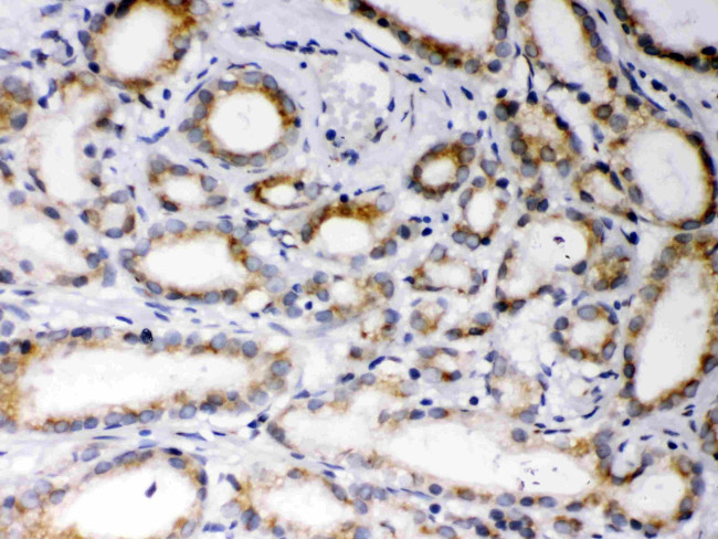 EBAG9 Antibody in Immunohistochemistry (Paraffin) (IHC (P))