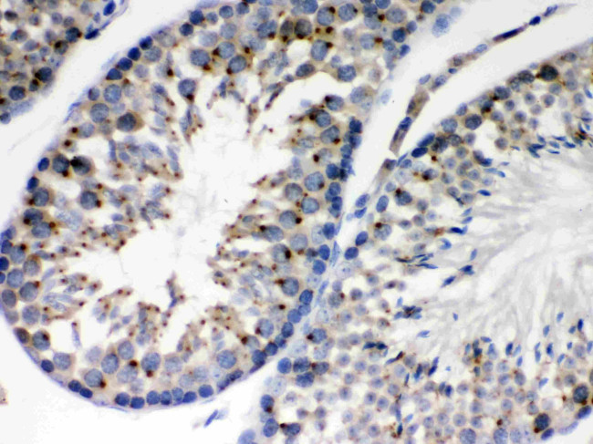 EBAG9 Antibody in Immunohistochemistry (Paraffin) (IHC (P))