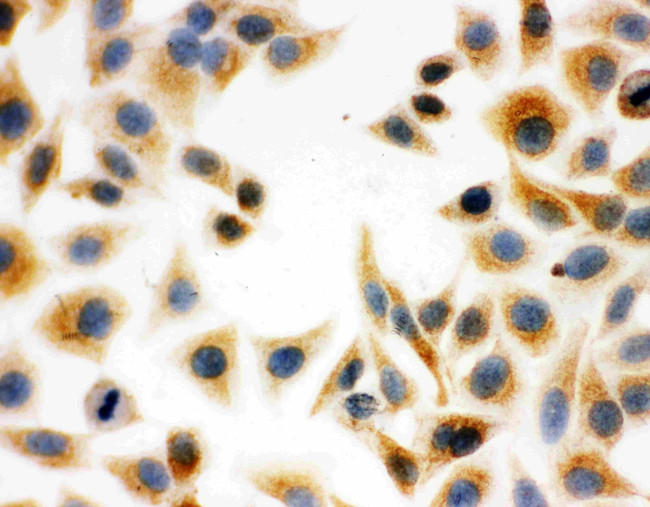 DCI Antibody in Immunocytochemistry (ICC/IF)