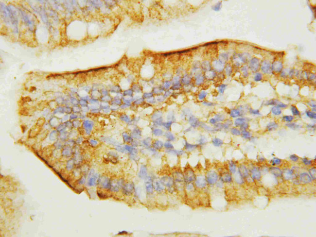 EGF Antibody in Immunohistochemistry (Paraffin) (IHC (P))