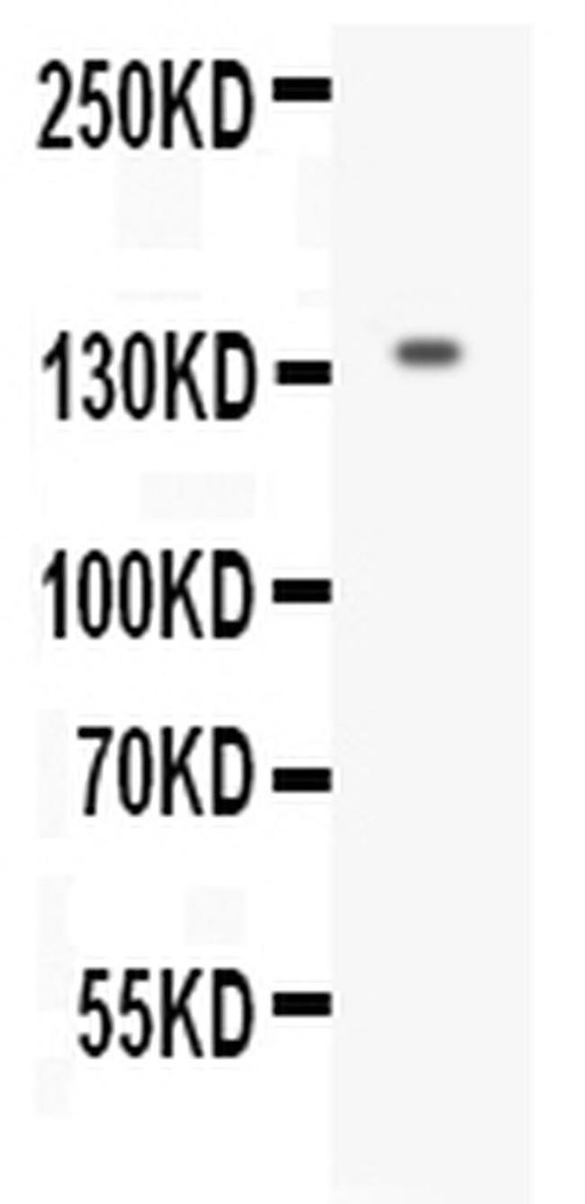 EGF Antibody in Western Blot (WB)