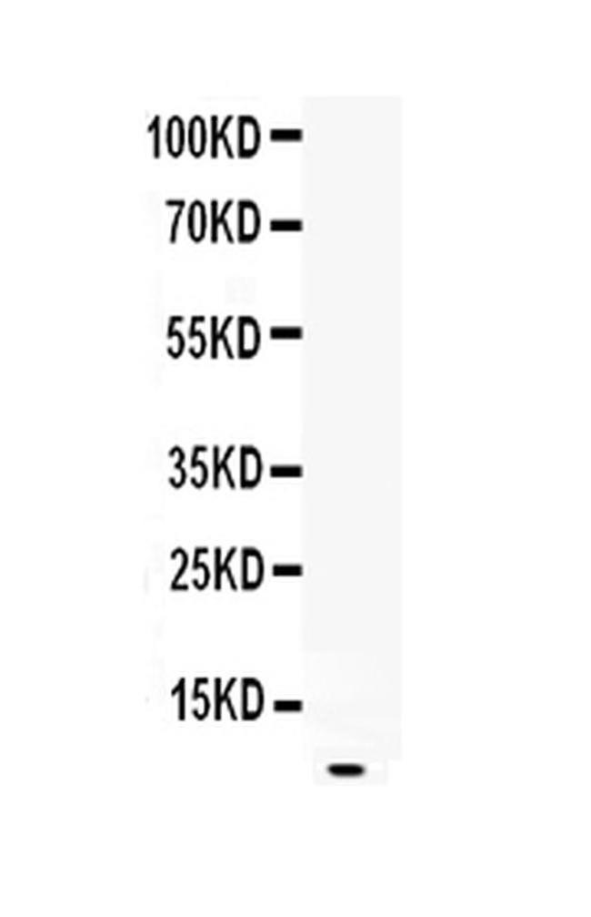 EGF Antibody in Western Blot (WB)