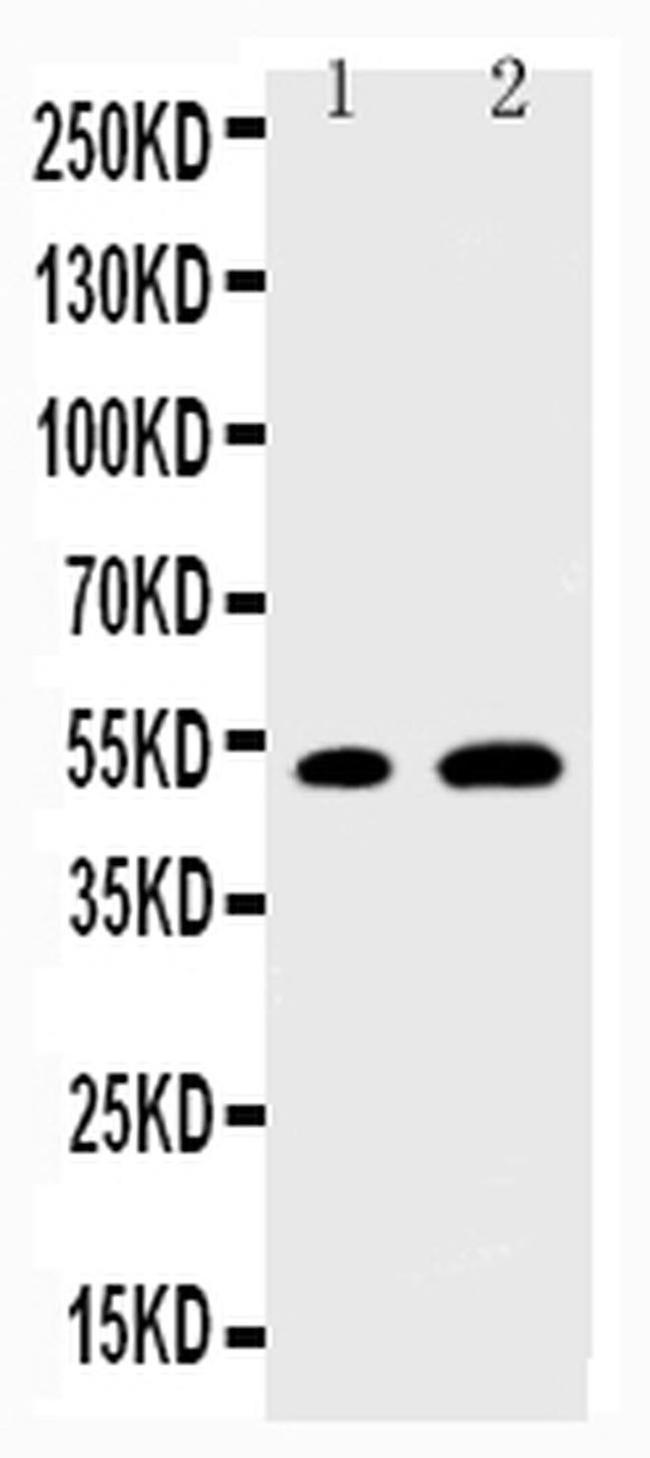 EGR2 Antibody in Western Blot (WB)