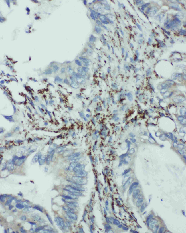 eIF6 Antibody in Immunohistochemistry (Paraffin) (IHC (P))