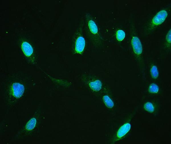 Emerin Antibody in Immunocytochemistry (ICC/IF)