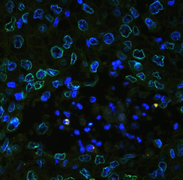 Emerin Antibody in Immunohistochemistry (Paraffin) (IHC (P))