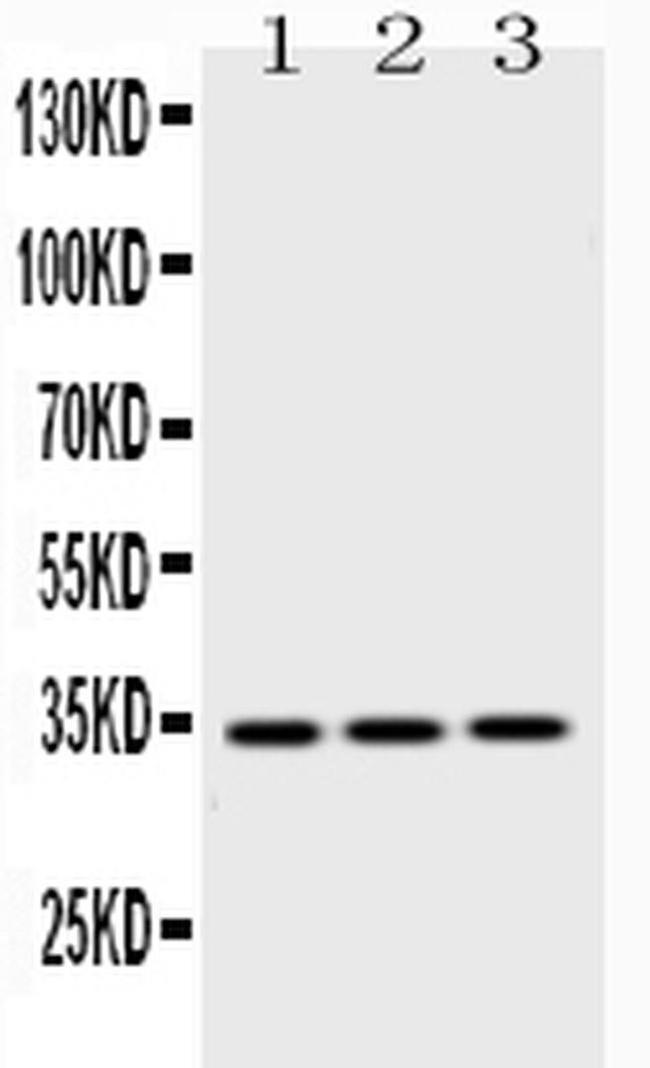 Emerin Antibody in Western Blot (WB)