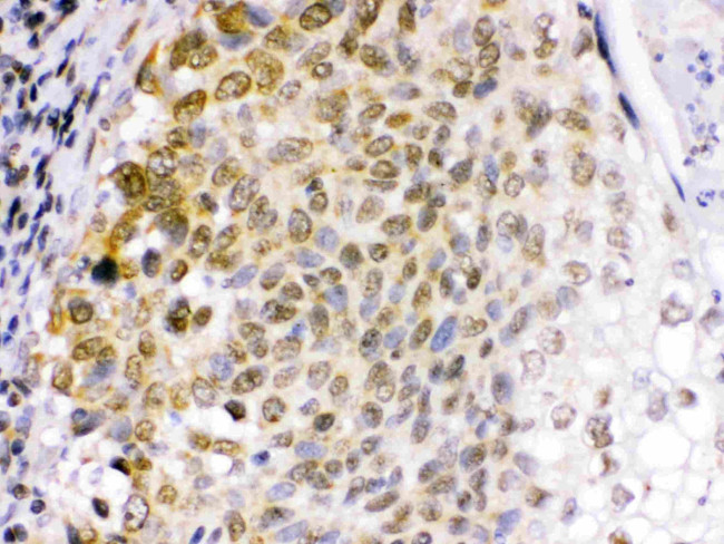 EME1 Antibody in Immunohistochemistry (Paraffin) (IHC (P))